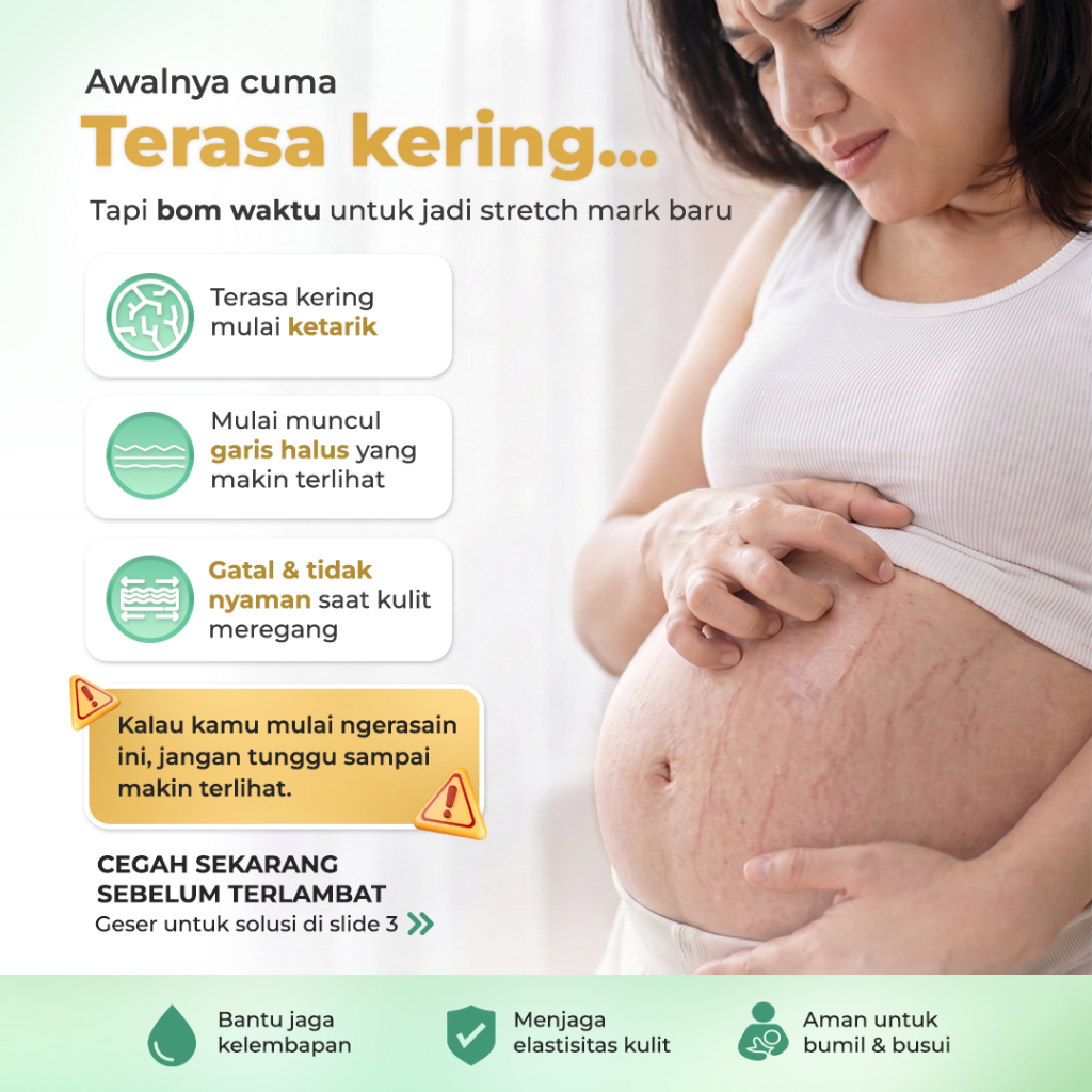 Stretchmark Cream - Image 2