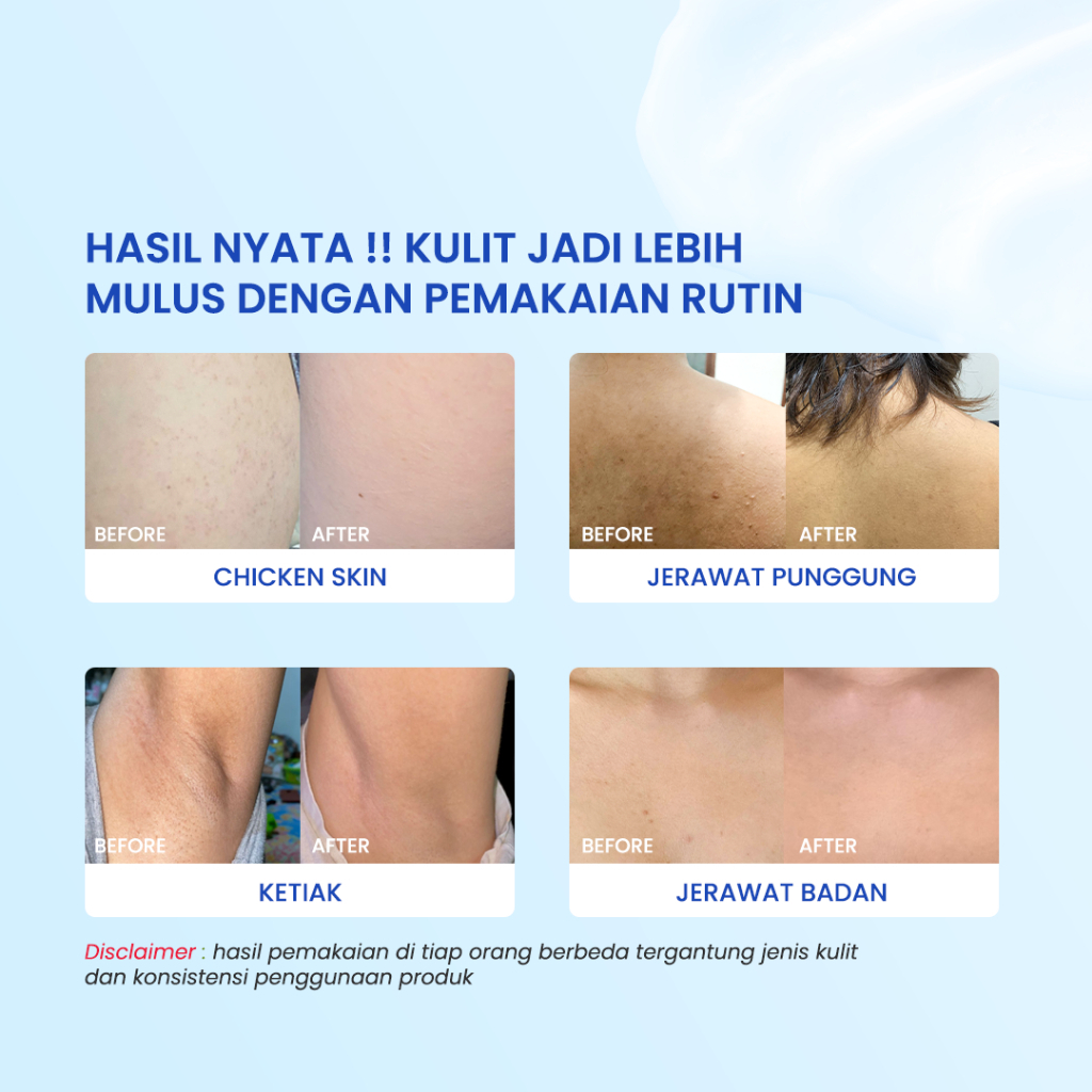 No Bump Lotion - Image 2