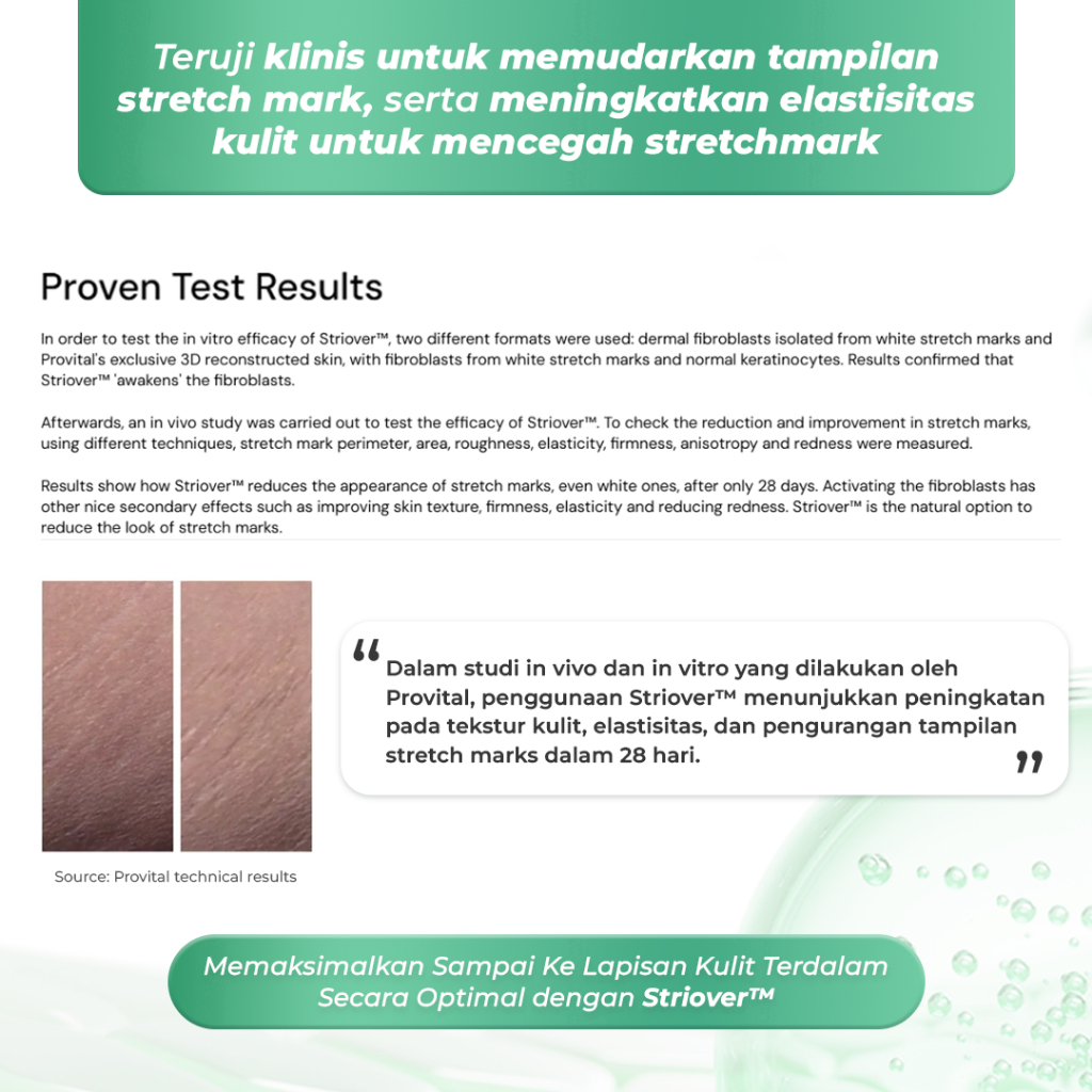 Stretch Mark Serum Booster - Image 8