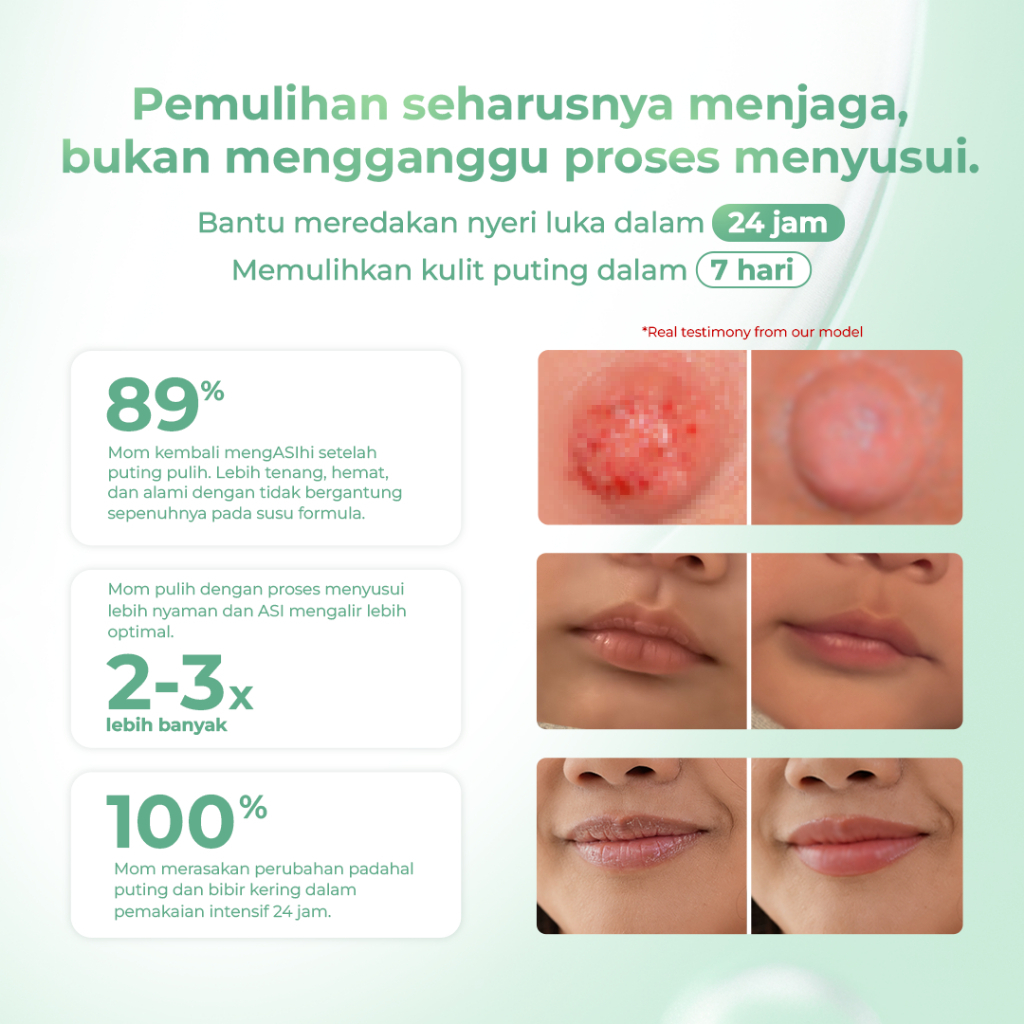 Lipnip Nipple Cream - Image 2