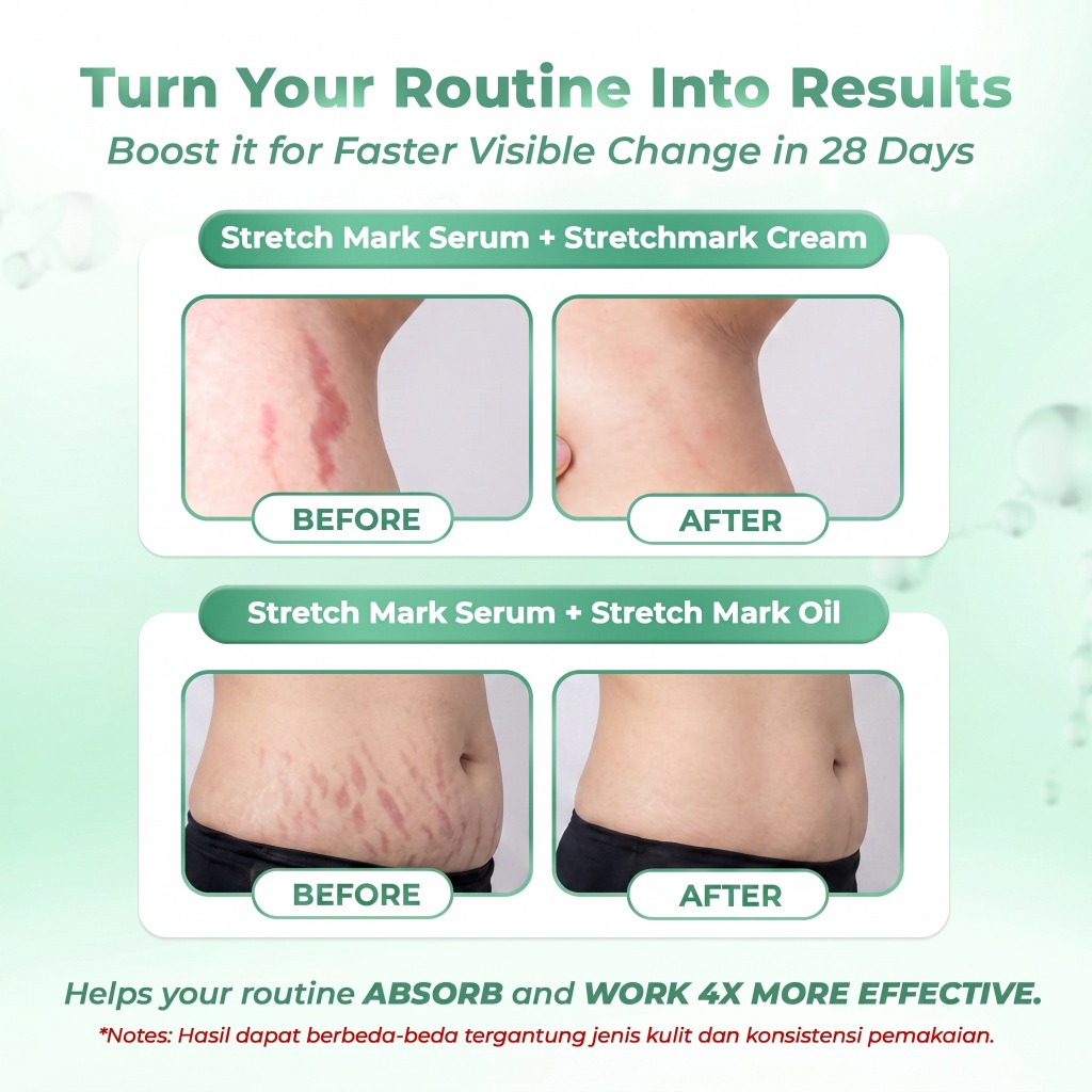 Bundling Stretch Mark Serum 1Pcs + Stretch Mark Oil 1Pcs + Stretch Mark Cream 1Pcs - Image 7