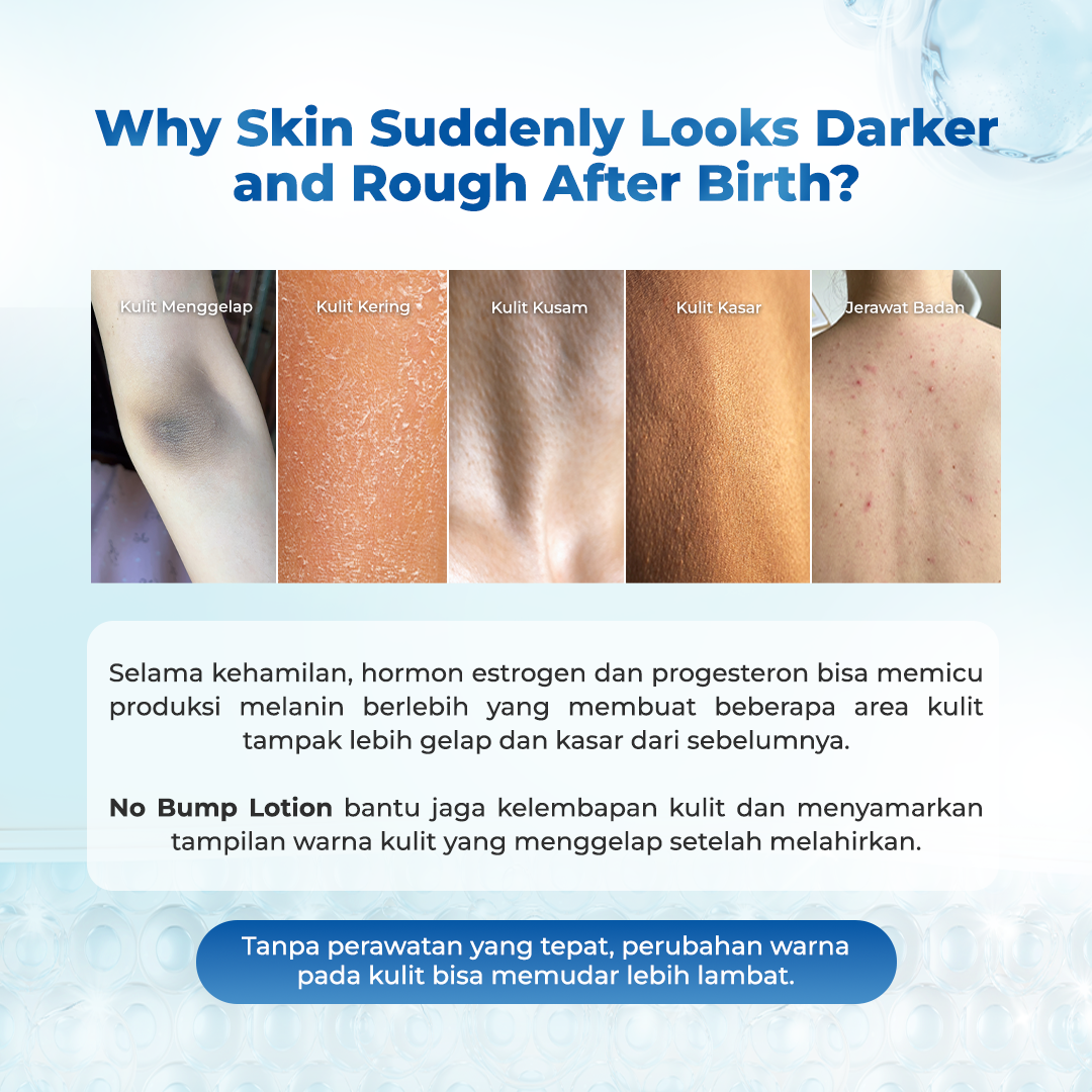 Rintik No Bump Lotion — Body Exfoliating Lotion untuk Kulit Tubuh Kasar, Bruntusan, Chicken Skin & Back Acne Setelah Melahirkan - Image 2