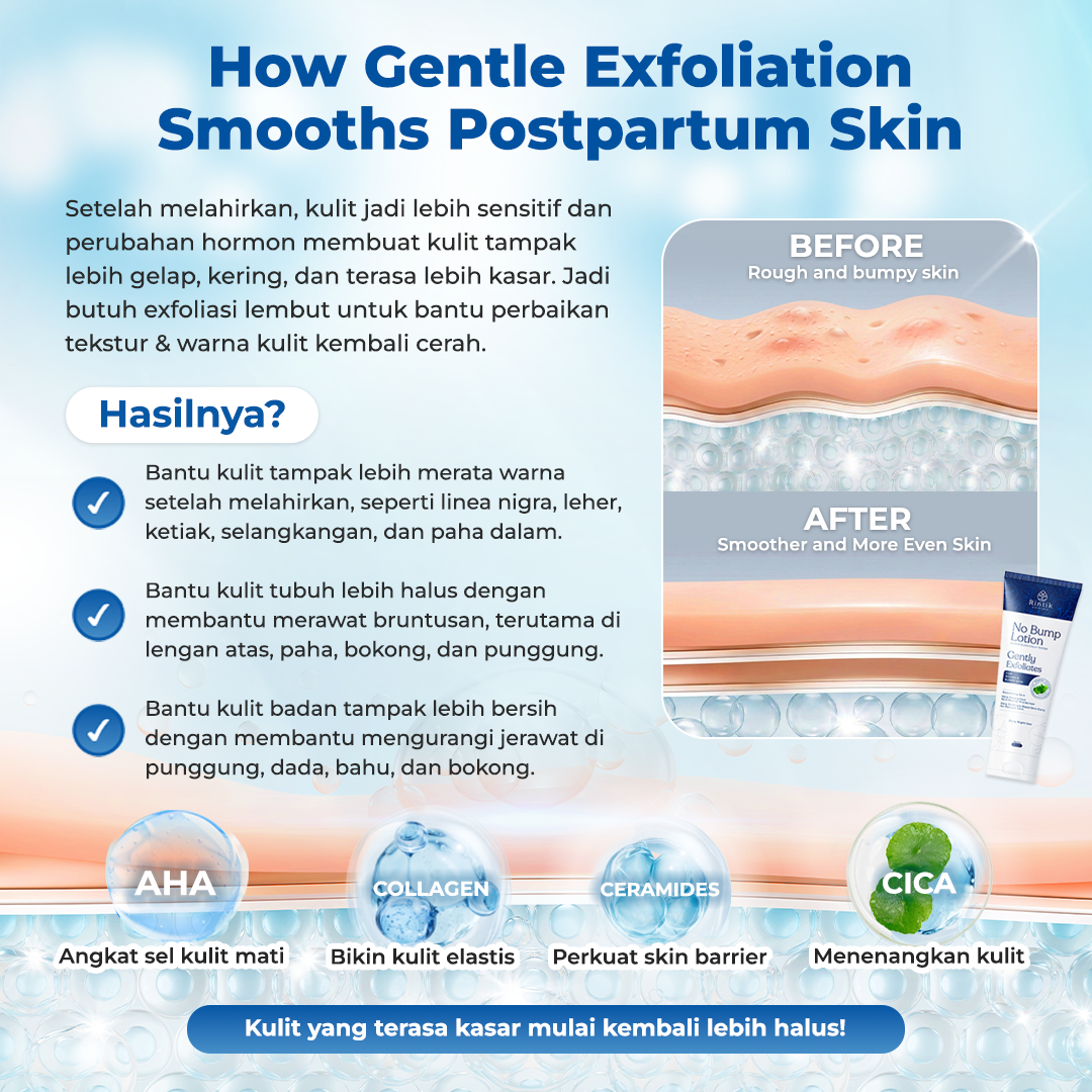 Rintik No Bump Lotion — Body Exfoliating Lotion untuk Kulit Tubuh Kasar, Bruntusan, Chicken Skin & Back Acne Setelah Melahirkan - Image 4