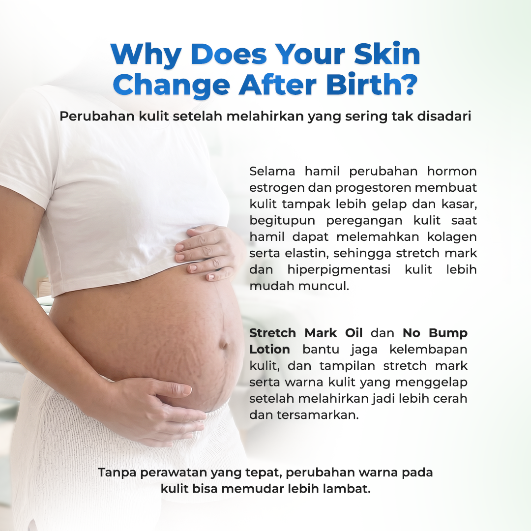 Rintik - Bundle Stretch Mark Cream + Stretch Mark Oil | HALAL BPOM | Penghilang Stretchmark Paling Ampuh (1 pcs Stretch Mark Oil 90 ml + 1pcs Stretchmark Cream 200 ml) - Image 4